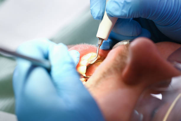 Best Same-Day Emergency Dental Services in Cave City, AR