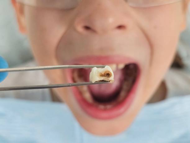 Best Emergency Denture Repair in Cave City, AR